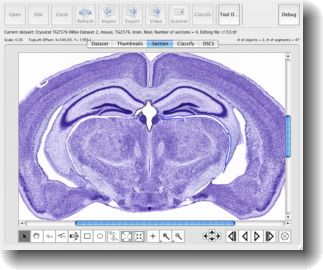 Atlas Maker section authoring