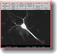 Loaded brain cell captured on a Zeiss laser confocal microscope