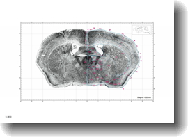 Stained brain section